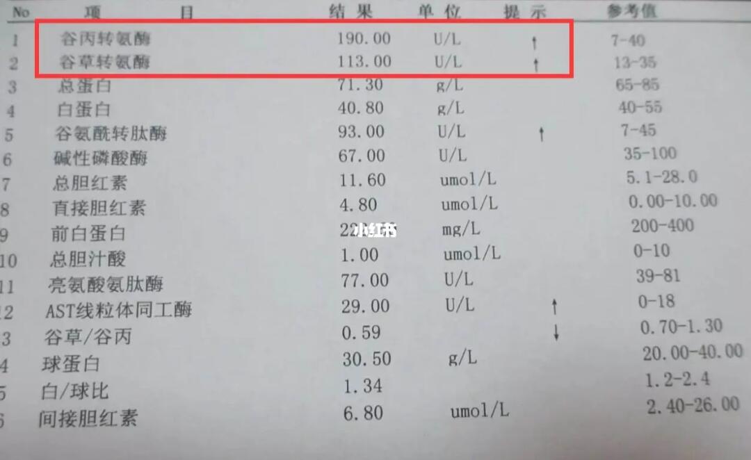 轉(zhuǎn)氨酶高多少是肝炎？解讀肝炎與轉(zhuǎn)氨酶水平的關(guān)系，解讀肝炎與轉(zhuǎn)氨酶水平關(guān)系，轉(zhuǎn)氨酶高多少可判定為肝炎？