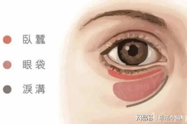 眼袋切除手術(shù)費(fèi)用詳解，價(jià)格因素與如何選擇合適的手術(shù)方案，眼袋切除手術(shù)費(fèi)用解析，了解價(jià)格因素與選擇最佳手術(shù)方案